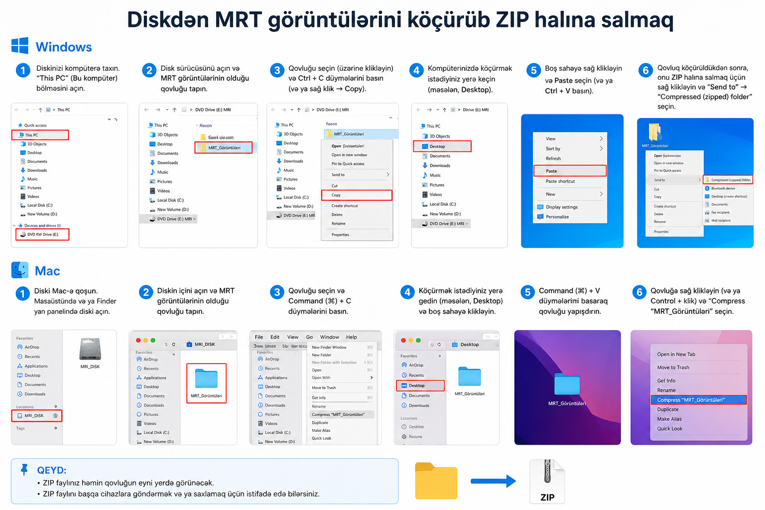 Disk ZIP